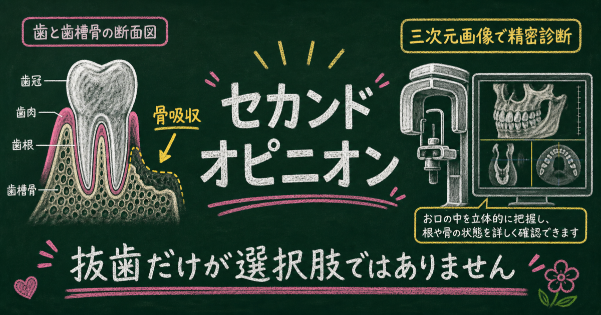 抜歯の診断を受けても、セカンドオピニオンで可能性を探る重要性