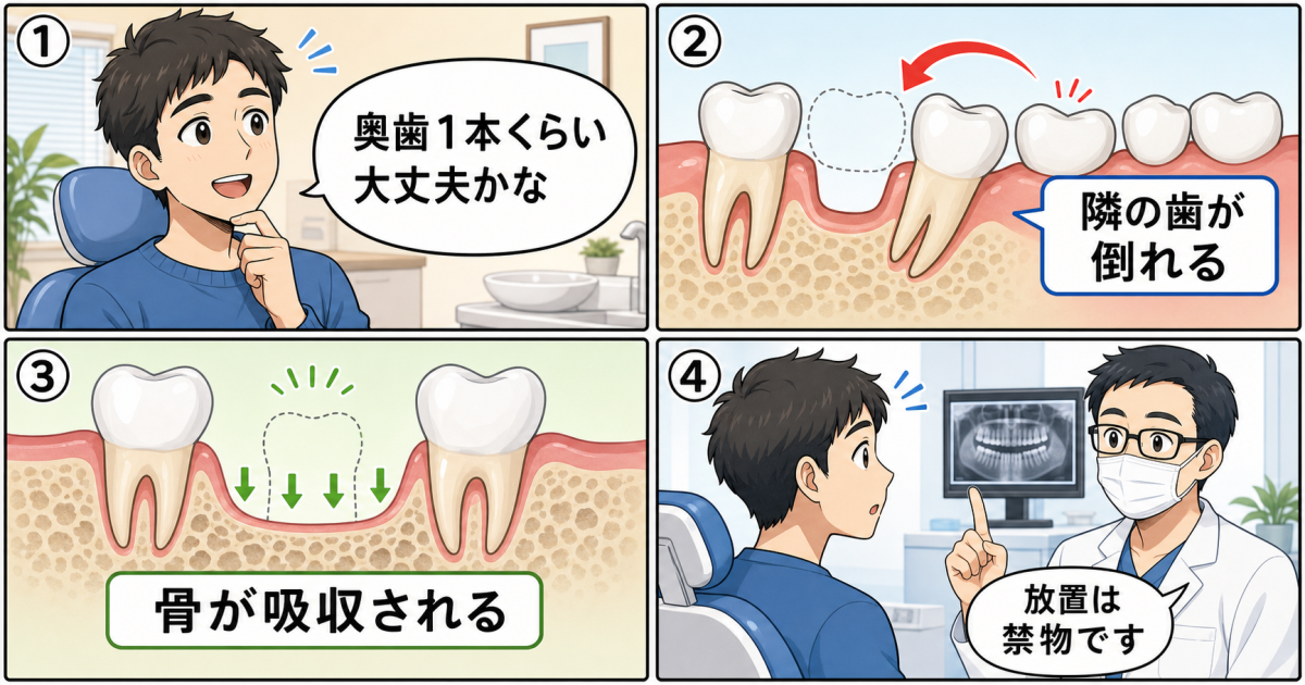 歯が1本抜けた状態を放置する3つの医学的リスクと口内の変化