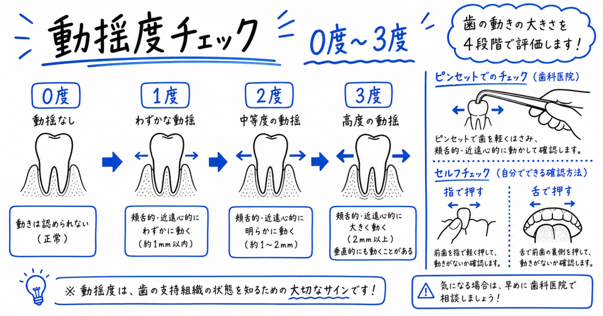 なぜ歯がグラグラして噛むと痛むのか?考えられる4つの主な原因