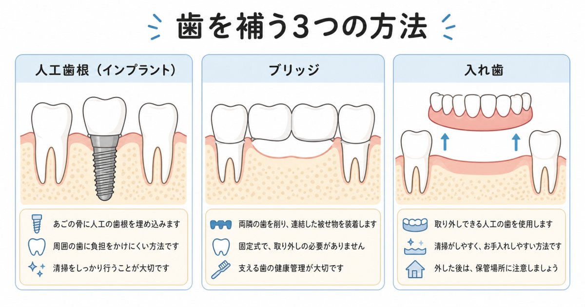 あごの骨が少なくても検討できる「骨造成(骨補填)」の選択肢