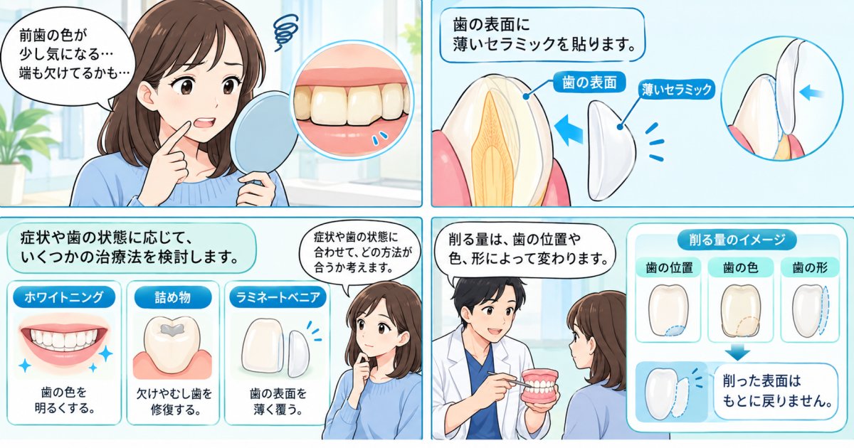 前歯の変色・小さな欠けにラミネートベニアは向く？削る量と注意点