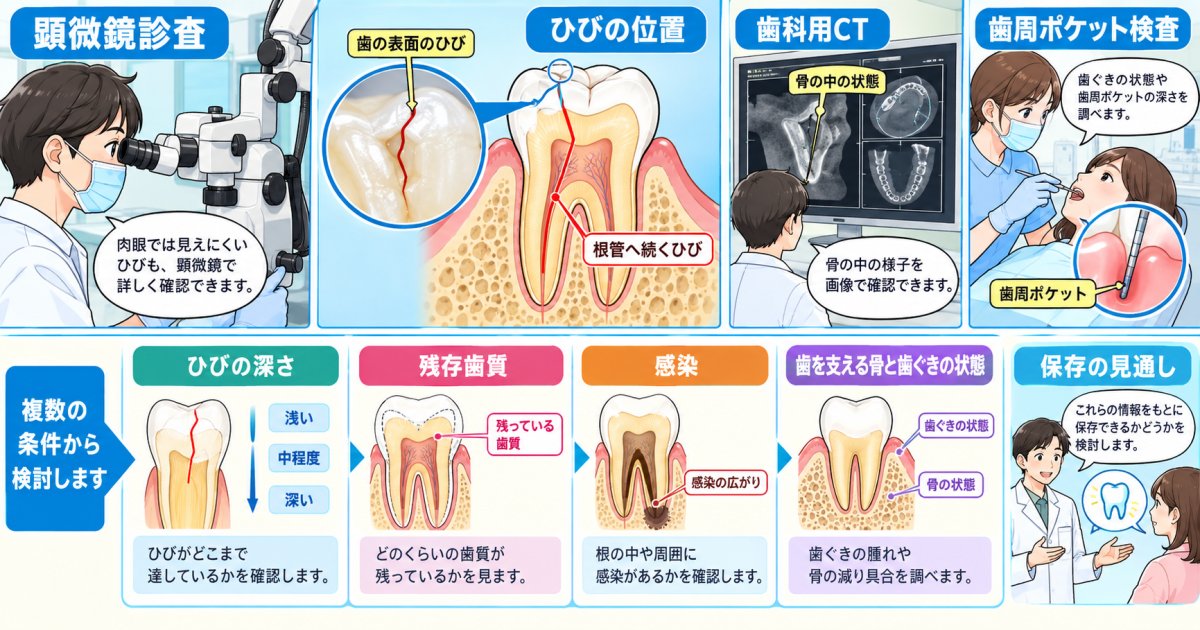抜歯宣告後のセカンドオピニオンで行う顕微鏡診査と歯を残せる条件
